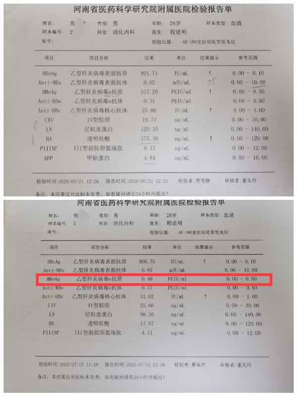 郑州看乙肝大三阳什么医院好