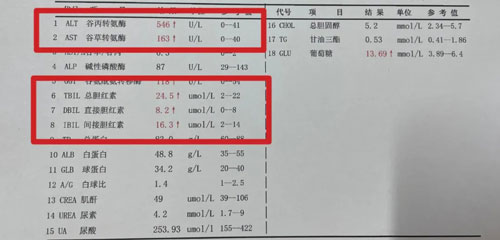 常怀利：乙肝活动期是治疗的关键时期，不要错过这个时机